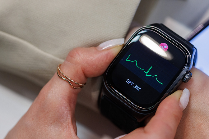 умные часы экг больница обследование 