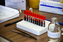 Россиян предупредили о риске рака и болезней сердца из-за нехватки витамина D